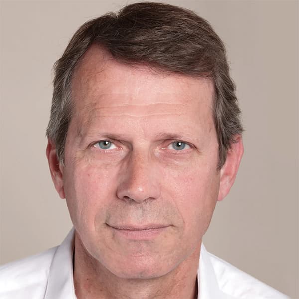 frederic-after-filler