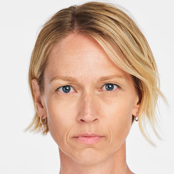 jackie-before-6month