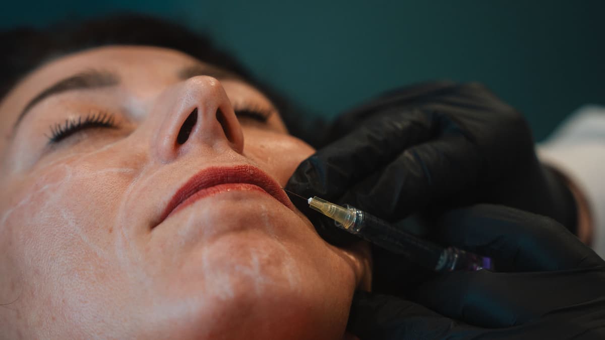 lip-filler-treatment
