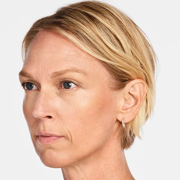 jackie-threequart-before