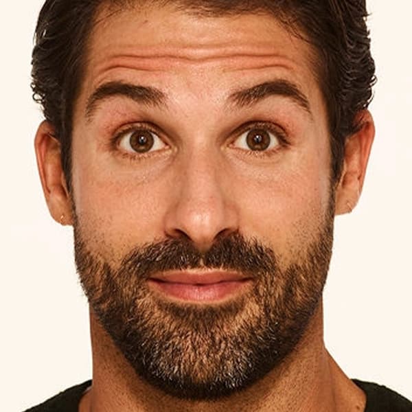 stephen-before-botox