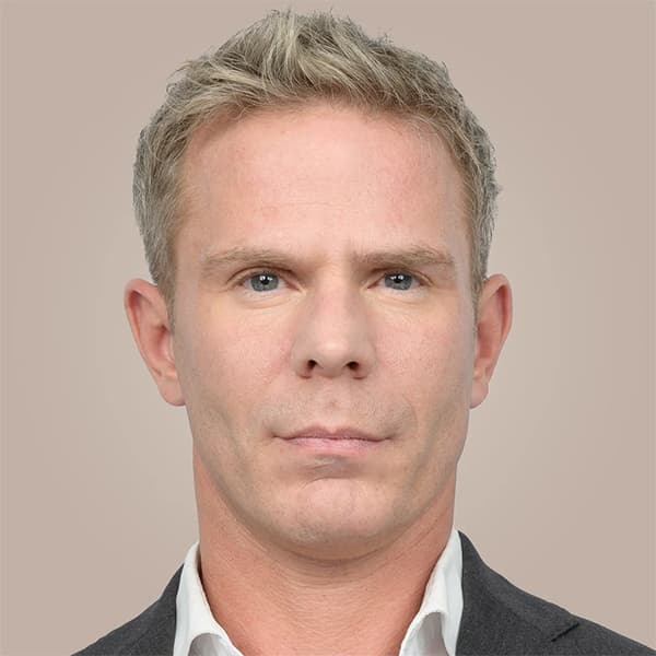 before-filler-christian