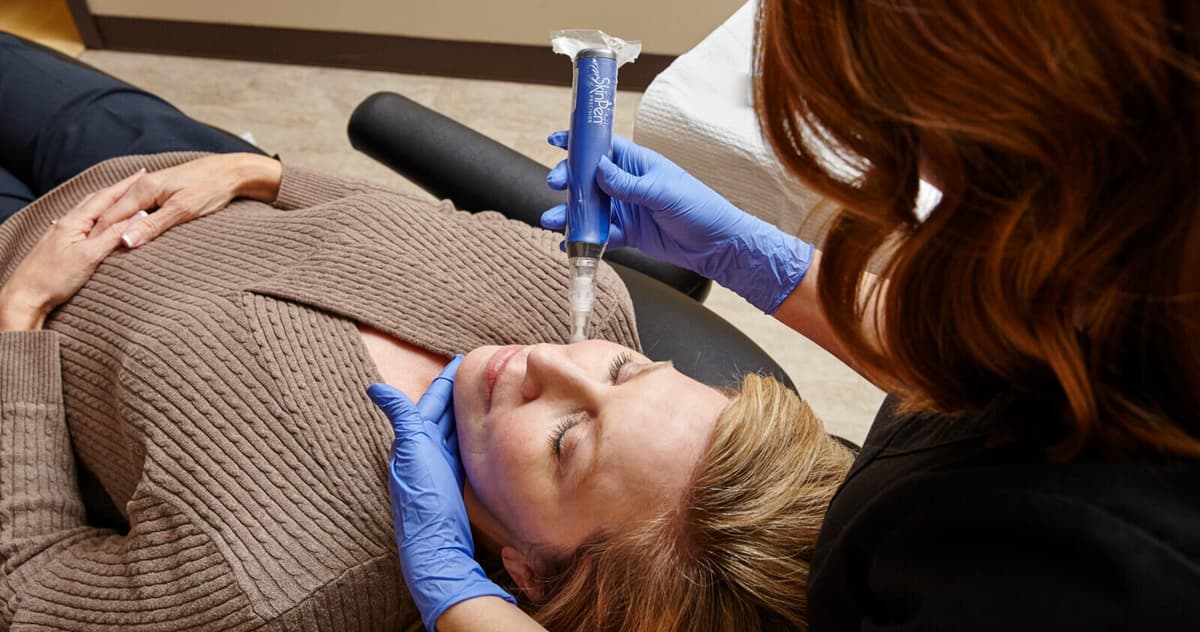 micro needling skinpen